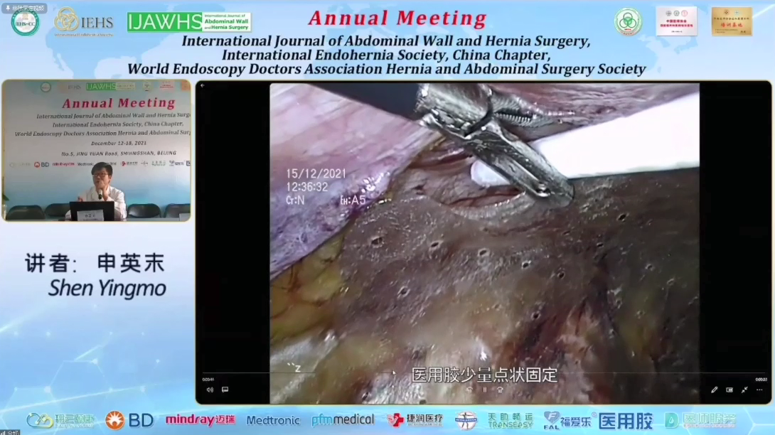 國際疝和腹壁外科雜志年會2021（福愛樂[00_25_03][20211227-200849].png